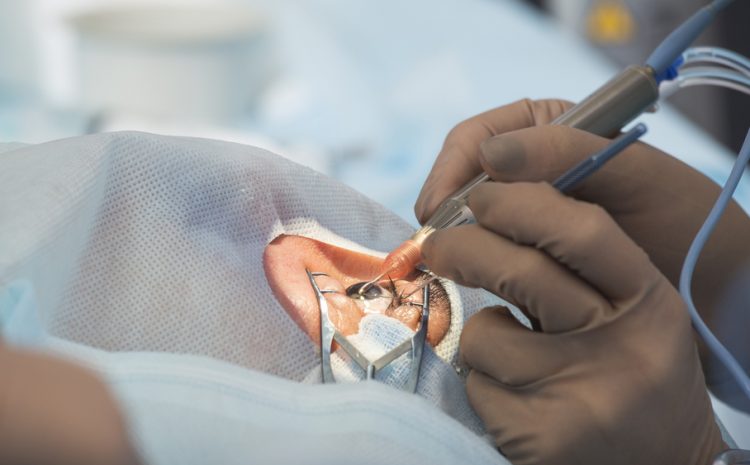 Risks of Retina Surgery